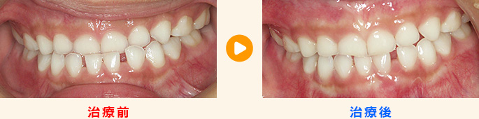 こどもの歯並び矯正 子どもの歯並び大丈夫 大田区西蒲田 島田歯科医院